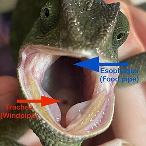 Trachea and Esophagus difference