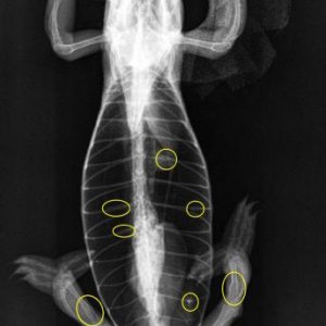 Multiple skeletal abnormalities