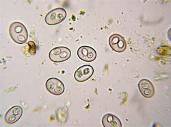 coccidia1