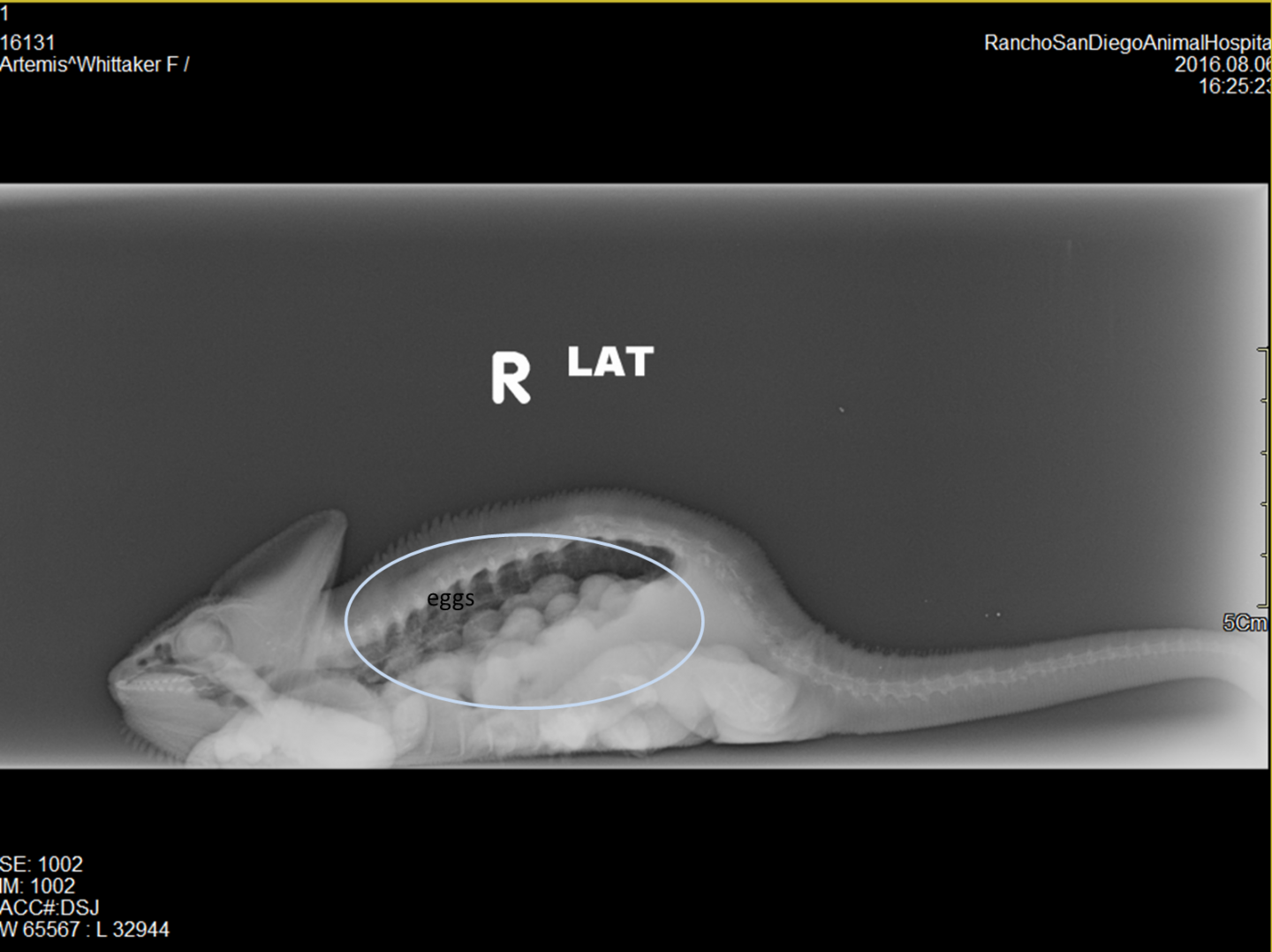 Lateral X-Ray